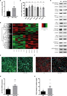Cell-Crossing Functional Network Driven by microRNA-125a Regulates Endothelial Permeability and Monocyte Trafficking in Acute Inflammation